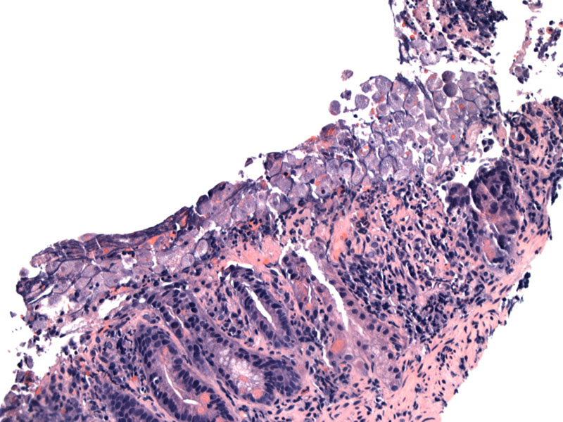 Pathology Image